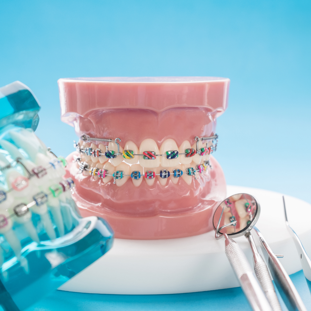 Re-Shaping Orthodontics With Tech